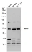 Anti-PLRG1 antibody used in Western Blot (WB). GTX117815