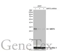 Anti-SIRT5 antibody used in Western Blot (WB). GTX117824