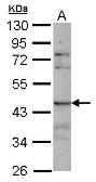 Anti-SIGLEC8 antibody [N1N3] used in Western Blot (WB). GTX117827
