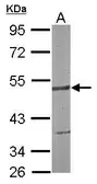 Anti-SMARCD3 antibody [N1C2] used in Western Blot (WB). GTX117831