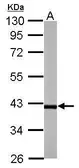 Anti-Rffl antibody [N2C3] used in Western Blot (WB). GTX117832