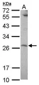Anti-SENP8 antibody [N1C3] used in Western Blot (WB). GTX117839