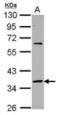 Anti-SNAP45 antibody [N2C3] used in Western Blot (WB). GTX117840