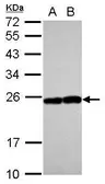 Anti-RAB17 antibody [N1C3] used in Western Blot (WB). GTX117846