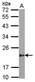 Anti-CSRP2 antibody [N1C3] used in Western Blot (WB). GTX117848