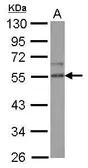Anti-SPRED2 antibody used in Western Blot (WB). GTX117851