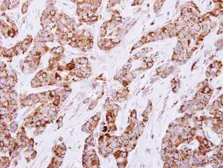Anti-CESK1 antibody used in IHC (Paraffin sections) (IHC-P). GTX117858