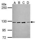 Anti-PCDH10 antibody [C2C3], C-term used in Western Blot (WB). GTX117862