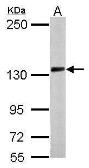 Anti-PCDH10 antibody [N1N2], N-term used in Western Blot (WB). GTX117863