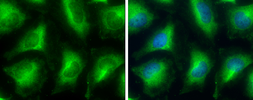 Anti-GPD1 antibody used in Immunocytochemistry/ Immunofluorescence (ICC/IF). GTX117910