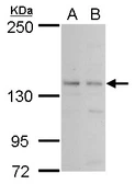 Anti-PAN2 antibody used in Western Blot (WB). GTX117916