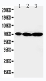 Anti-MEKK2 antibody used in Western Blot (WB). GTX11792