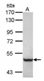 Anti-TRIM68 antibody [C1C3] used in Western Blot (WB). GTX117922