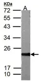 Anti-ASF1B antibody used in Western Blot (WB). GTX117936