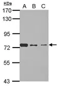 Anti-SENP3 antibody used in Western Blot (WB). GTX117938