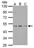 Anti-SF3B4 antibody used in Western Blot (WB). GTX117942
