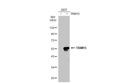 Anti-TRIM15 antibody [N2C2], Internal used in Western Blot (WB). GTX117947