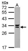 Anti-Syntenin 2 antibody [N2C3] used in Western Blot (WB). GTX117949