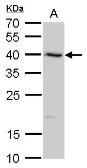 Anti-SerpinB8 antibody used in Western Blot (WB). GTX117950