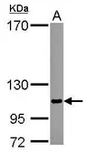 Anti-SENP5 antibody [C1C3] used in Western Blot (WB). GTX117955