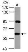 Anti-VAM1 antibody [N1C1] used in Western Blot (WB). GTX117968