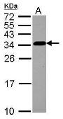 Anti-CKAP1 antibody [N1C3-2] used in Western Blot (WB). GTX117972