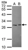 Anti-HECTD2 antibody [N1N3] used in Western Blot (WB). GTX117974