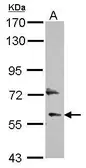 Anti-DEPDC7 antibody used in Western Blot (WB). GTX117979