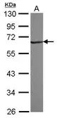 Anti-RNF25 antibody [N1C1] used in Western Blot (WB). GTX117993