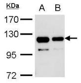 Anti-V5 tag antibody used in Immunoprecipitation (IP). GTX117997