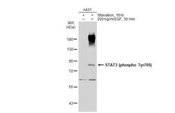 Anti-STAT3 (phospho Tyr705) antibody used in Western Blot (WB). GTX118000