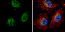 Anti-HEY1 antibody used in Immunocytochemistry/ Immunofluorescence (ICC/IF). GTX118007