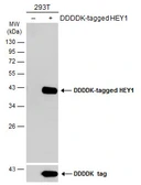 Anti-HEY1 antibody used in Western Blot (WB). GTX118007