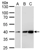 Anti-Calponin 3 antibody used in Western Blot (WB). GTX118017