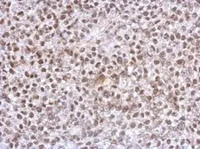 Anti-Homeobox C10 antibody used in IHC (Paraffin sections) (IHC-P). GTX118025