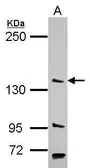 Anti-PAN2 antibody [C2C3], C-term used in Western Blot (WB). GTX118028
