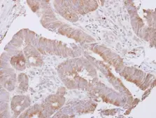 Anti-LANCL1 antibody used in IHC (Paraffin sections) (IHC-P). GTX118029