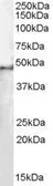 Anti-SF3B4 antibody, N-term used in Western Blot (WB). GTX11803