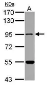 Anti-MARS2 antibody [N1N2], N-term used in Western Blot (WB). GTX118031