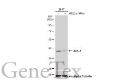 Anti-ARG2 antibody used in Western Blot (WB). GTX118048