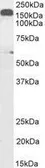 Anti-DCTN1 antibody, C-term used in Western Blot (WB). GTX11806