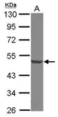 Anti-DCP2 antibody used in Western Blot (WB). GTX118062
