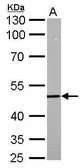 Anti-DCP2 antibody used in Western Blot (WB). GTX118062