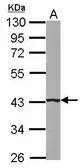 Anti-B4GALT5 antibody used in Western Blot (WB). GTX118066