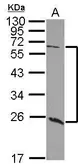 Anti-GALNT9 antibody [C1C3] used in Western Blot (WB). GTX118076