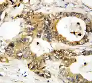 Anti-Annexin III antibody used in IHC (Paraffin sections) (IHC-P). GTX11808