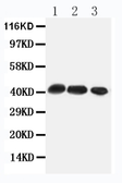 Anti-CCR4 antibody used in Western Blot (WB). GTX11809