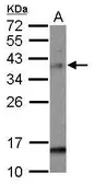 Anti-MAD2L1BP antibody [N1C3] used in Western Blot (WB). GTX118095