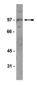 Anti-Kaiso antibody [2T15] used in Western Blot (WB). GTX11810