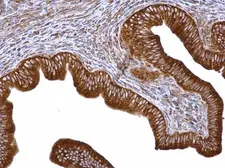 Anti-EIF4G3 antibody [N1], N-term used in IHC (Paraffin sections) (IHC-P). GTX118109